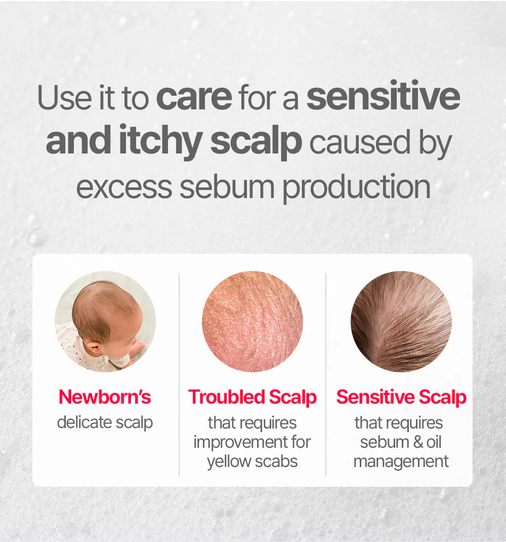 ATOPALM Newborn Scalp Lotion 100g