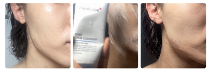 MEDICUBE ZERO Foam Cleansing 120ml